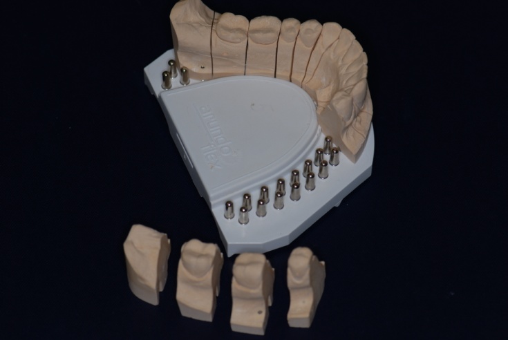 Изготовление разборной модели нижней челюсти